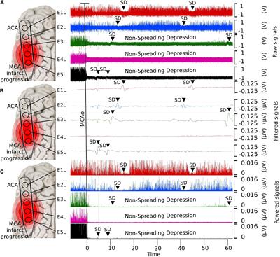 Spatial and temporal frequency band changes during infarct induction, infarct progression, and spreading depolarizations in the gyrencephalic brain